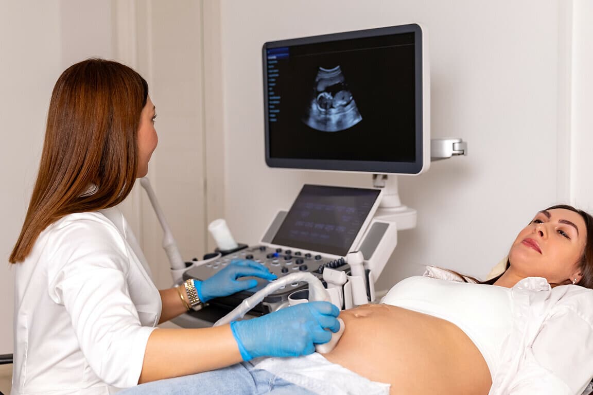 Ultrasound diagnostic system